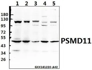 WB analysis of various samples using GTX66726 PSMD11 antibody. Lane1 : HEK293T whole cell lysate(40ug) Lane2 : PANC1 whole cell lysate(40ug) Lane3 : L02 whole cell lysate(40ug) Lane4 : H9C2 whole cell lysate(40ug) Lane5 : CT26 whole cell lysate(40ug) Dilution : 1:500
