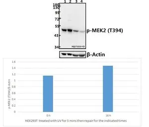 WB analysis of various samples using GTX66729 MEK2 (phospho Thr394) antibody. Lane1 : HEK293T whole cell lysate(40ug) Lane2 : HEK293T treated with UV for 5 minutes then repair for 16 hours whole cell lysate(40ug) Lane3 : The Kidney tissue lysate of Rat(40ug) Lane4 : The Kidney tissue lysate of Mouse(40ug) Dilution : 1:2000 WB analysis of various samples using GTX66729 MEK2 (phospho Thr394) antibody. Lane1 : HEK293T whole cell lysate(40ug) Lane2 : HEK293T treated with UV for 5 minutes then repair for 16 hours whole cell lysate(40ug) Lane3 : The Kidney tissue lysate of Rat(40ug) Lane4 : The Kidney tissue lysate of Mouse(40ug) Dilution : 1:2000