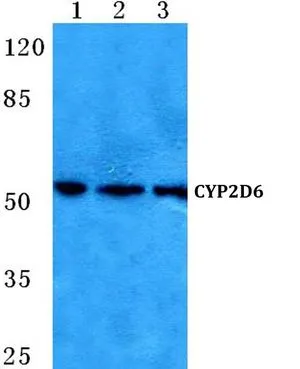 WB analysis of various samples using GTX66735 Cytochrome P450 2D6 antibody. Lane1 : MCF-7 cell lysate Lane2 : NIH-3T3 cell lysate Lane3 : H9C2 cell lysate Dilution : 1:500 WB analysis of various samples using GTX66735 Cytochrome P450 2D6 antibody. Lane1 : MCF-7 cell lysate Lane2 : NIH-3T3 cell lysate Lane3 : H9C2 cell lysate Dilution : 1:500