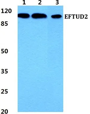 WB analysis of various samples using GTX66744 EFTUD2 antibody. Lane1 : MCF-7 cell lysate Lane2 : sp2/0 cell lysate Lane3 : H9C2 cell lysate Dilution : 1:500 WB analysis of various samples using GTX66744 EFTUD2 antibody. Lane1 : MCF-7 cell lysate Lane2 : sp2/0 cell lysate Lane3 : H9C2 cell lysate Dilution : 1:500