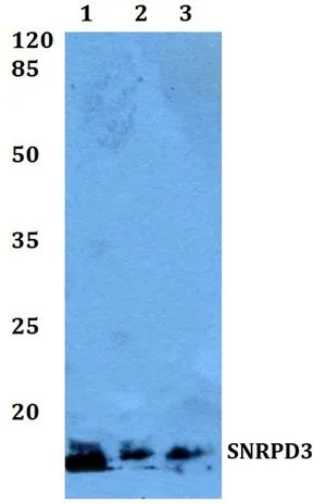 WB analysis of various samples using GTX66749 SNRPD3 antibody. Lane1 : Jurkat whole cell lysate Lane2 : Mouse brain tissue lysate Lane3 : H9C2 whole cell lysate Dilution : 1:500 WB analysis of various samples using GTX66749 SNRPD3 antibody. Lane1 : Jurkat whole cell lysate Lane2 : Mouse brain tissue lysate Lane3 : H9C2 whole cell lysate Dilution : 1:500