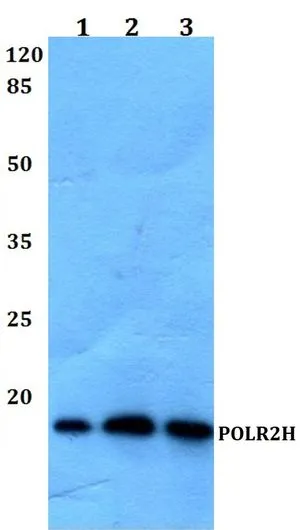 WB analysis of various samples using GTX66751 RPB8 antibody. Lane1 : Hela whole cell lysate Lane2 : Mouse liver tissue lysate Lane3 : Rat iver tissue lysate Dilution : 1:500 WB analysis of various samples using GTX66751 RPB8 antibody. Lane1 : Hela whole cell lysate Lane2 : Mouse liver tissue lysate Lane3 : Rat iver tissue lysate Dilution : 1:500