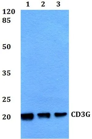WB analysis of various samples using GTX66759 CD3 gamma antibody. Lane1 : HEK293T whole cell lysate Lane2 : Raw264.7 whole cell lysate Lane3 : H9C2 whole cell lysate Dilution : 1:500 WB analysis of various samples using GTX66759 CD3 gamma antibody. Lane1 : HEK293T whole cell lysate Lane2 : Raw264.7 whole cell lysate Lane3 : H9C2 whole cell lysate Dilution : 1:500