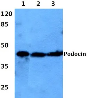 WB analysis of various samples using GTX66764 NPHS2 antibody. Lane1 : Hela cell lysate Lane2 : NIH-3T3 cell lysate Lane3 : PC12 cell lysate Dilution : 1:500 WB analysis of various samples using GTX66764 NPHS2 antibody. Lane1 : Hela cell lysate Lane2 : NIH-3T3 cell lysate Lane3 : PC12 cell lysate Dilution : 1:500