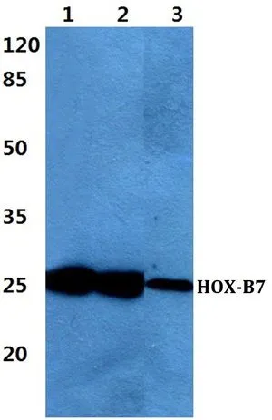 WB analysis of various samples using GTX66766 HOXB7 antibody. Lane1 : Hela cell lysate Lane2 : Raw264.7 cell lysate Lane3 : H9C2 cell lysate Dilution : 1:500 WB analysis of various samples using GTX66766 HOXB7 antibody. Lane1 : Hela cell lysate Lane2 : Raw264.7 cell lysate Lane3 : H9C2 cell lysate Dilution : 1:500