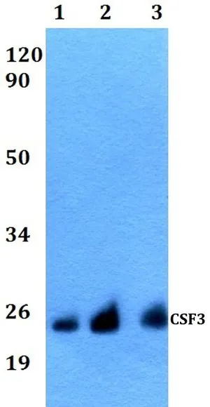 WB analysis of various samples using GTX66773 G-CSF antibody. Lane1 : Hela whole cell lysate Lane2 : Raw264.7 whole cell lysate Lane3 : PC12 whole cell lysate Dilution : 1:500 WB analysis of various samples using GTX66773 G-CSF antibody. Lane1 : Hela whole cell lysate Lane2 : Raw264.7 whole cell lysate Lane3 : PC12 whole cell lysate Dilution : 1:500