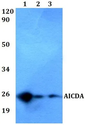 WB analysis of various samples using GTX66775 AICDA antibody. Lane1 : MCF-7 whole cell lysate Lane2 : sp2/0 whole cell lysate Lane3 : PC12 whole cell lysate Dilution : 1:500 WB analysis of various samples using GTX66775 AICDA antibody. Lane1 : MCF-7 whole cell lysate Lane2 : sp2/0 whole cell lysate Lane3 : PC12 whole cell lysate Dilution : 1:500