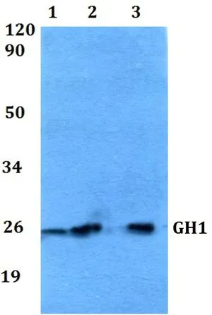 WB analysis of various samples using GTX66777 Growth Hormone antibody. Lane1 : HEK293T whole cell lysate Lane2 : sp2/0 whole cell lysate Lane3 : PC12 whole cell lysate Dilution : 1:500 WB analysis of various samples using GTX66777 Growth Hormone antibody. Lane1 : HEK293T whole cell lysate Lane2 : sp2/0 whole cell lysate Lane3 : PC12 whole cell lysate Dilution : 1:500