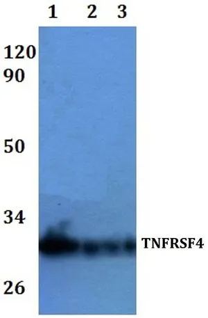 WB analysis of various samples using GTX66792 CD134 antibody. Lane1 : HEK293T whole cell lysate Lane2 : RAW264.7 whole cell lysate Lane3 : H9C2 whole cell lysate Dilution : 1:500 WB analysis of various samples using GTX66792 CD134 antibody. Lane1 : HEK293T whole cell lysate Lane2 : RAW264.7 whole cell lysate Lane3 : H9C2 whole cell lysate Dilution : 1:500