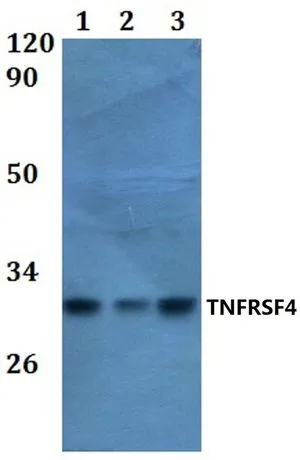WB analysis of various samples using GTX66795 CD134 antibody. Lane1 : HEK293T whole cell lysate Lane2 : RAW264.7 whole cell lysate Lane3 : H9C2 whole cell lysate Dilution : 1:500 WB analysis of various samples using GTX66795 CD134 antibody. Lane1 : HEK293T whole cell lysate Lane2 : RAW264.7 whole cell lysate Lane3 : H9C2 whole cell lysate Dilution : 1:500