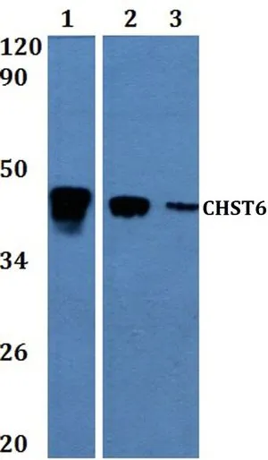 WB analysis of various samples using GTX66796 CHST6 antibody. Lane1 : MCF-7 whole cell lysate Lane2 : H9C2 whole cell lysate Lane3 : sp20 whole cell lysate Dilution : 1:500 WB analysis of various samples using GTX66796 CHST6 antibody. Lane1 : MCF-7 whole cell lysate Lane2 : H9C2 whole cell lysate Lane3 : sp20 whole cell lysate Dilution : 1:500