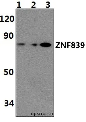 WB analysis of various samples using GTX66807 ZNF839 antibody. Lane1 : H9C2 whole cell lysate(40ug) Lane2 : RAW264.7 whole cell lysat(40ug) Lane3 : Hela whole cell lysate(40ug) Dilution : 1:500 WB analysis of various samples using GTX66807 ZNF839 antibody. Lane1 : H9C2 whole cell lysate(40ug) Lane2 : RAW264.7 whole cell lysat(40ug) Lane3 : Hela whole cell lysate(40ug) Dilution : 1:500