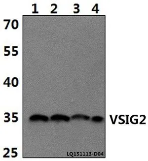 WB analysis of various samples using GTX66808 VSIG2 antibody. Lane1 : DLD whole cell lysate(40ug) Lane2 : The Stomach tissue lysate of Rat(30ug) Lane3 : The Stomach tissue lysate of Mouse(30ug) Lane4 : PC3 whole cell lysate(40ug) Dilution : 1:500 WB analysis of various samples using GTX66808 VSIG2 antibody. Lane1 : DLD whole cell lysate(40ug) Lane2 : The Stomach tissue lysate of Rat(30ug) Lane3 : The Stomach tissue lysate of Mouse(30ug) Lane4 : PC3 whole cell lysate(40ug) Dilution : 1:500