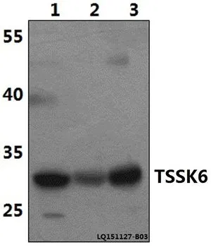 WB analysis of various samples using GTX66809 TSSK6 antibody. Lane1 : Hela whole cell lysate(40ug) Lane2 : The Testis tissue lysate of Rat(40ug) Lane3 : The Testis tissue lysate of Mouse(40ug) Dilution : 1:500 WB analysis of various samples using GTX66809 TSSK6 antibody. Lane1 : Hela whole cell lysate(40ug) Lane2 : The Testis tissue lysate of Rat(40ug) Lane3 : The Testis tissue lysate of Mouse(40ug) Dilution : 1:500