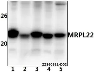 WB analysis of various samples using GTX66814 MRPL22 antibody. Lane1 : THP-1 whole cell lysate(40ug) Lane2 : Hela whole cell lysate(40ug) Lane3 : HEK293T whole cell lysate(40ug) Lane4 : PC12 whole cell lysate(40ug) Lane5 : AML-12 whole cell lysate(40ug) Dilution : 1:500 WB analysis of various samples using GTX66814 MRPL22 antibody. Lane1 : THP-1 whole cell lysate(40ug) Lane2 : Hela whole cell lysate(40ug) Lane3 : HEK293T whole cell lysate(40ug) Lane4 : PC12 whole cell lysate(40ug) Lane5 : AML-12 whole cell lysate(40ug) Dilution : 1:500