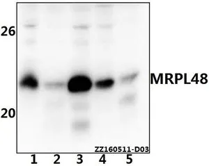 WB analysis of various samples using GTX66815 MRPL48 antibody. Lane1 : THP-1 whole cell lysate(40ug) Lane2 : Hela whole cell lysate(40ug) Lane3 : HEK293T whole cell lysate(40ug) Lane4 : PC12 whole cell lysate(40ug) Lane5 : AML-12 whole cell lysate(40ug) Dilution : 1:500 WB analysis of various samples using GTX66815 MRPL48 antibody. Lane1 : THP-1 whole cell lysate(40ug) Lane2 : Hela whole cell lysate(40ug) Lane3 : HEK293T whole cell lysate(40ug) Lane4 : PC12 whole cell lysate(40ug) Lane5 : AML-12 whole cell lysate(40ug) Dilution : 1:500