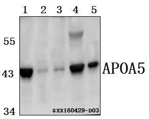 WB analysis of various samples using GTX66816 Apolipoprotein A5 antibody. Lane1 : HCT116 whole cell lysate(40ug) Lane2 : The Brain tissue lysate of Mouse(40ug) Lane3 : The Brain tissue lysate of Rat(40ug) Lane4 : C6 whole cell lysate(40ug) Lane5 : A549 whole cell lysate(40ug) Dilution : 1:500 WB analysis of various samples using GTX66816 Apolipoprotein A5 antibody. Lane1 : HCT116 whole cell lysate(40ug) Lane2 : The Brain tissue lysate of Mouse(40ug) Lane3 : The Brain tissue lysate of Rat(40ug) Lane4 : C6 whole cell lysate(40ug) Lane5 : A549 whole cell lysate(40ug) Dilution : 1:500