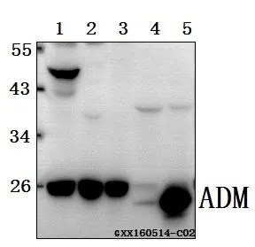 WB analysis of various samples using GTX66817 Adrenomedullin antibody. Lane1 : HCT116 whole cell lysate(40ug) Lane2 : A549 whole cell lysate(40ug) Lane3 : HEK293T whole cell lysate(40ug) Lane4 : The Kidney lysate of Rat(40ug) Lane5 : The Kidney lysate of Mouse (40ug) Dilution : 1:500 WB analysis of various samples using GTX66817 Adrenomedullin antibody. Lane1 : HCT116 whole cell lysate(40ug) Lane2 : A549 whole cell lysate(40ug) Lane3 : HEK293T whole cell lysate(40ug) Lane4 : The Kidney lysate of Rat(40ug) Lane5 : The Kidney lysate of Mouse (40ug) Dilution : 1:500