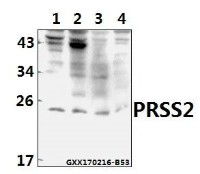WB analysis of various samples using GTX66818 PRSS2 antibody. Lane1 : HT102 whole cell lysate(40ug) Lane2 : SW620 whole cell lysate(40ug) Lane3 : CT26 whole cell lysate(40ug) Lane4 : PC12 whole cell lysate(40ug) Dilution : 1:500 WB analysis of various samples using GTX66818 PRSS2 antibody. Lane1 : HT102 whole cell lysate(40ug) Lane2 : SW620 whole cell lysate(40ug) Lane3 : CT26 whole cell lysate(40ug) Lane4 : PC12 whole cell lysate(40ug) Dilution : 1:500