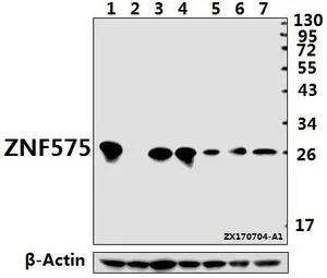 WB analysis of various samples using GTX66823 ZNF575 antibody. Lane1 : Hela whole cell lysate(40ug) Lane2 : HEK293T whole cell lysate(40ug) Lane3 : CT26 whole cell lysate(40ug) Lane4 : AML-12 whole cell lysate(40ug) Lane5 : C6 whole cell lysate(40ug) La Dilution : 1:500 WB analysis of various samples using GTX66823 ZNF575 antibody. Lane1 : Hela whole cell lysate(40ug) Lane2 : HEK293T whole cell lysate(40ug) Lane3 : CT26 whole cell lysate(40ug) Lane4 : AML-12 whole cell lysate(40ug) Lane5 : C6 whole cell lysate(40ug) La Dilution : 1:500