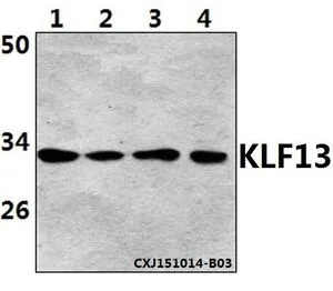 WB analysis of various samples using GTX66827 KLF13 (acetyl lys166) antibody. Lane1 : Hela whole cell lysate(40ug) Lane2 : Jurkat whole cell lysate(40ug) Lane3 : NIH-3T3 whole cell lysate(40ug) Lane4 : PC12 whole cell lysate(40ug) Dilution : 1:500 WB analysis of various samples using GTX66827 KLF13 (acetyl lys166) antibody. Lane1 : Hela whole cell lysate(40ug) Lane2 : Jurkat whole cell lysate(40ug) Lane3 : NIH-3T3 whole cell lysate(40ug) Lane4 : PC12 whole cell lysate(40ug) Dilution : 1:500