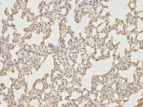 IHC-P analysis of rat lung tissue using GTX66828 IL6 antibody. IHC-P analysis of rat lung tissue using GTX66828 IL6 antibody.