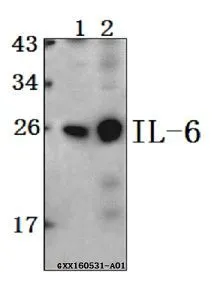 WB analysis of various samples using GTX66828 IL6 antibody. Lane1 : HCC827 whole cell lysate(40ug) Lane2 : PC3 whole cell lysate(40ug) Dilution : 1:500