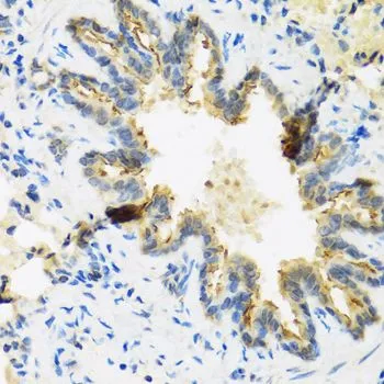IHC-P analysis of rat lung tissue using GTX66832 Defensin beta 4B antibody. Dilution : 1:100 IHC-P analysis of rat lung tissue using GTX66832 Defensin beta 4B antibody. Dilution : 1:100