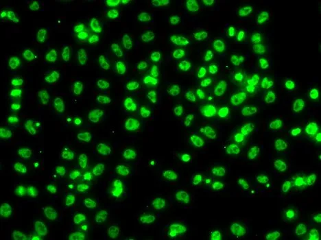 ICC/IF analysis of A549 cells using GTX66834 AXUD1 antibody. ICC/IF analysis of A549 cells using GTX66834 AXUD1 antibody.