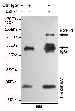 IP analysis of HeLa whole cell lysate using GTX66839 E2F1 antibody [4G8].