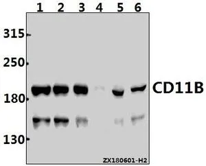 WB analysis of various samples using GTX66849 CD11b antibody [L1]. Lane1 : Myla2059 whole cell lysate(30ug) Lane2 : HuT78 whole cell lysate(30ug) Lane3 : K562 whole cell lysate(30ug) Lane4 : The Spleen tissue lysate of Rat(40ug) Lane5 : RAW264.7 whole cell lysate(40ug) Lane6 : THP-1 whole cell lysate(40ug) Dilution : 1:500