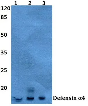 WB analysis of various samples using GTX66854 Defensin alpha 4 antibody. Lane1 : MCF-7 cell lysate Lane2 : Mouse spleen tissue lysate Lane3 : Rat spleen tissue lysate Dilution : 1:500