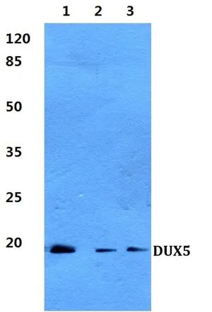 WB analysis of various samples using GTX66859 DUX5 antibody. Lane1 : HepG2 cell lysate Lane2 : H9C2 cell lysate Lane3 : Rat liver tissue lysate Dilution : 1:500 WB analysis of various samples using GTX66859 DUX5 antibody. Lane1 : HepG2 cell lysate Lane2 : H9C2 cell lysate Lane3 : Rat liver tissue lysate Dilution : 1:500