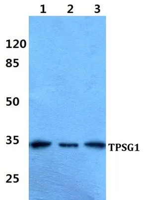 WB analysis of various samples using GTX66860 TPSG1 antibody. Lane1 : A549 cell lysate Lane2 : sp2/0 cell lysate Lane3 : H9C2 cell lysate Dilution : 1:500 WB analysis of various samples using GTX66860 TPSG1 antibody. Lane1 : A549 cell lysate Lane2 : sp2/0 cell lysate Lane3 : H9C2 cell lysate Dilution : 1:500
