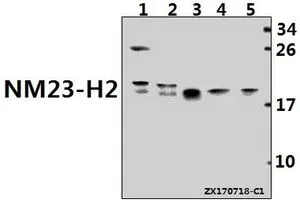 WB analysis of various samples using GTX66869 nm23-H2 antibody. Lane1 : MCF-7 whole cell lysate(40ug) Lane2 : HEK293T whole cell lysate(40ug) Lane3 : Hela whole cell lysate(40ug) Lane4 : H9C2 whole cell lysate(40ug) Lane5 : BV2 whole cell lysate(40ug) Dilution : 1:500 WB analysis of various samples using GTX66869 nm23-H2 antibody. Lane1 : MCF-7 whole cell lysate(40ug) Lane2 : HEK293T whole cell lysate(40ug) Lane3 : Hela whole cell lysate(40ug) Lane4 : H9C2 whole cell lysate(40ug) Lane5 : BV2 whole cell lysate(40ug) Dilution : 1:500