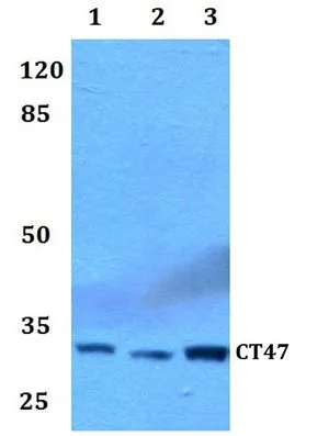 WB analysis of various samples using GTX66875 CT47 antibody. Lane1 : HEK293T whole cell lysate Lane2 : Raw264.7 whole cell lysate Lane3 : PC12 whole cell lysate Dilution : 1:500