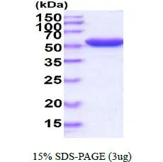 3 &#956;g of GTX66884-pro G6PD protein (active) by SDS-PAGE under reducing condition and visualized by coomassie blue stain