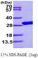 3 ?g of GTX66887-pro Uridine phosphorypase protein (active) by SDS-PAGE under reducing condition and visualized by coomassie blue stain