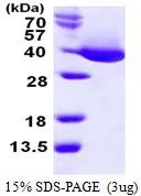 3 ?g of GTX66891-pro Malate dehydrogenase protein (active) by SDS-PAGE under reducing condition and visualized by coomassie blue stain