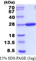 3 &#956;g of GTX66896-pro Carbonic anhydrase protein (active) by SDS-PAGE under reducing condition and visualized by coomassie blue stain