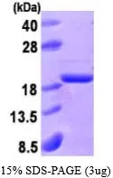 3 ?g of GTX66900-pro Human ACP1 protein (active) by SDS-PAGE under reducing condition and visualized by coomassie blue stain