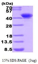 3 ?g of GTX66916-pro Human AKR7A2 protein (active) by SDS-PAGE under reducing condition and visualized by coomassie blue stain