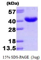 3 ?g of GTX66917-pro Human AKR7A3 protein (active) by SDS-PAGE under reducing condition and visualized by coomassie blue stain