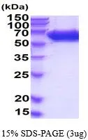 3 ?g of GTX66924-pro Mouse Alkaline Phosphatase (Tissue Non-Specific)  protein (active) by SDS-PAGE under reducing condition and visualized by coomassie blue stain