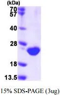 3 ?g of GTX66975-pro Human DUSP3 protein (active) by SDS-PAGE under reducing condition and visualized by coomassie blue stain