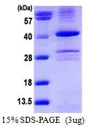 3 ?g of GTX67136-pro Human PPP1A protein (active) by SDS-PAGE under reducing condition and visualized by coomassie blue stain