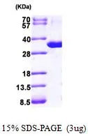 3 ?g of GTX67149-pro Human Purine nucleoside phosphorylase protein (active) by SDS-PAGE under reducing condition and visualized by coomassie blue stain