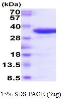 3 ?g of GTX67173-pro Human TRAP protein (active) by SDS-PAGE under reducing condition and visualized by coomassie blue stain