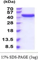 3 ?g of GTX67182-pro Mouse UGDH protein (active) by SDS-PAGE under reducing condition and visualized by coomassie blue stain