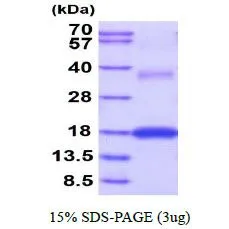 3 ?g of GTX67184-pro Mouse VEGFA protein (active) by SDS-PAGE under reducing condition and visualized by coomassie blue stain